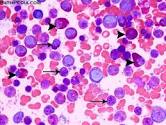 CML Microscopic Image 5 4 2015